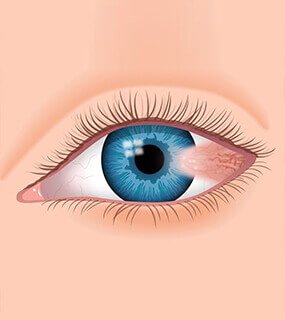 Best Eye Care Doctors Agra
