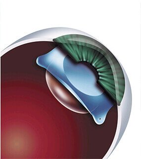 Best Eye Specialist in Agra