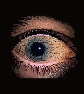 Eye Hospital in Agra