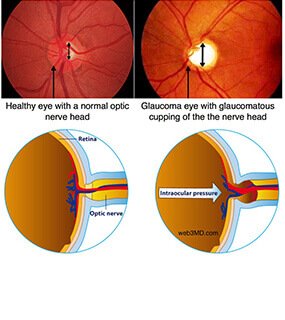 Best Eye Specialist in Agra