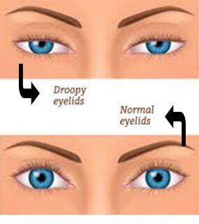 Best Eye Specialist in Agra