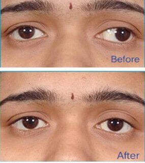Best Eye Specialist in Agra