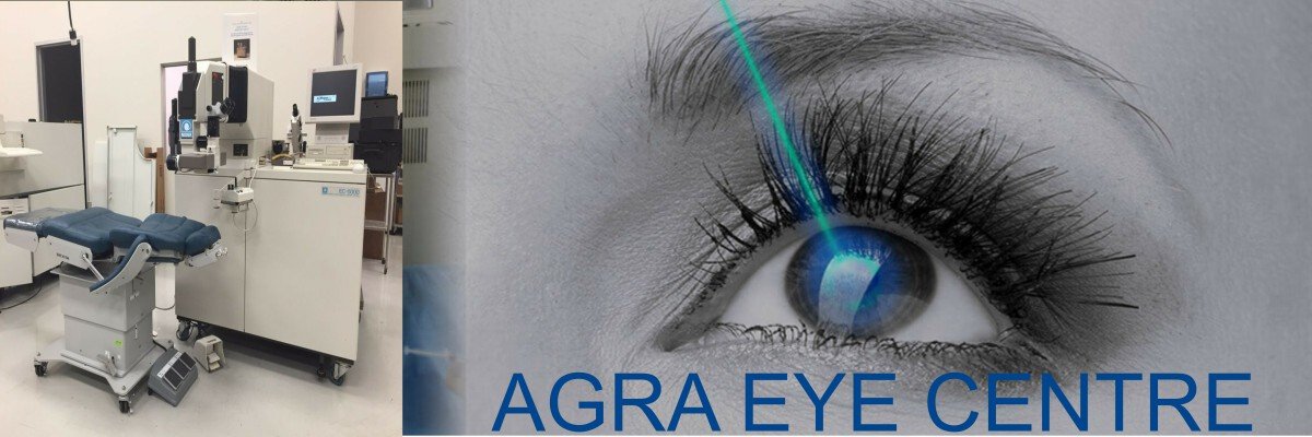 Best Lasik Surgery Hospital in Agra